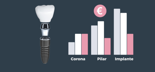 Precio Completo De Implantes Dentales En 【 2024