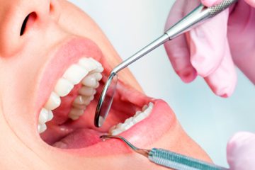 Cuanto Cuesta Un Empaste Dental 2021 Ferrus Bratos