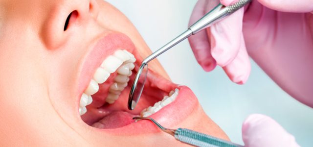 Caries Que Tipos Hay Clinica Dental Ferrus Bratos