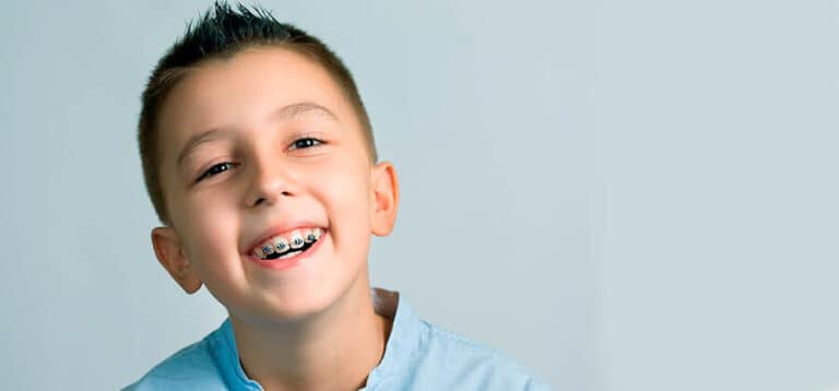 Brackets Para Niños: ¿Qué Ventajas Tienen Y Qué Problemas Corrigen?