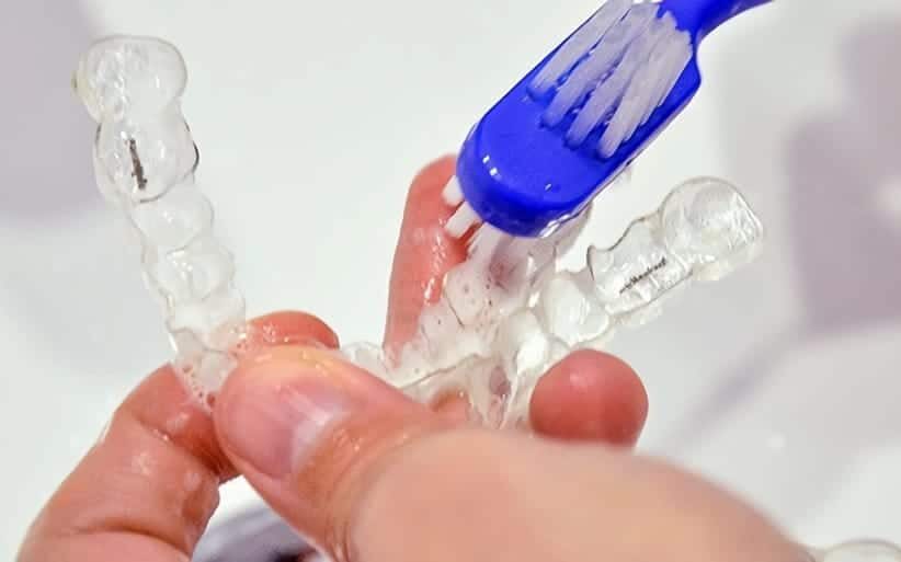 Limpieza y mantenimiento de Férulas (Invisalign, retenedores ortodoncia,  Férulas de descarga) 