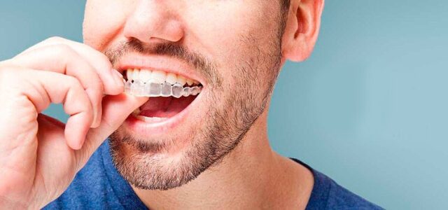 Fases Del Tratamiento Con Invisalign Ferrus Bratos