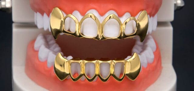 Grillz' dentales: tendencia de llevar joyas en los dientes - GRUPO DERF