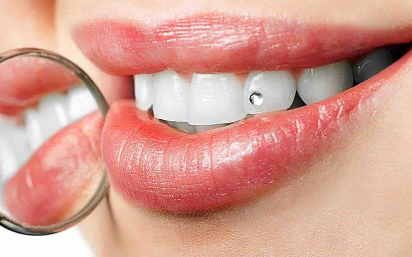 Adorno de Metal para dientes dentales, gemas dentales de varias formas,  joyería, decoración de gemas de
