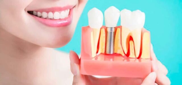 Necesito Un Implante Dental, ¿duele La Cirugía? | Ferrus&Bratos