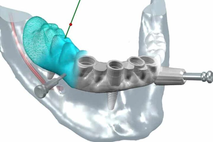 Nombres De Los Dientes: ¿cómo Se Llama Cada Uno? | Ferrus&Bratos