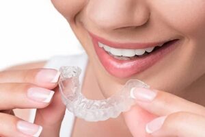 Invisalign: Cuándo Está Indicado Y Qué Ventajas Tiene | Ferrus&Bratos