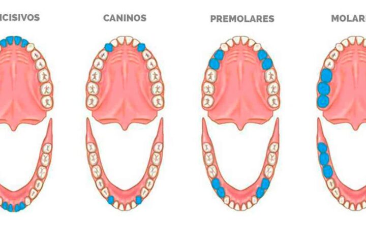 Nombres De Los Dientes: Descubre Cómo Se Llaman | Ferrus&Bratos