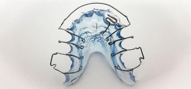 Retenedores en ortodoncia ¿son útiles?