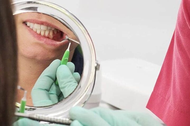 Gingivectomía Qué Es En Qué Consiste Beneficios Y Tratamiento 3595