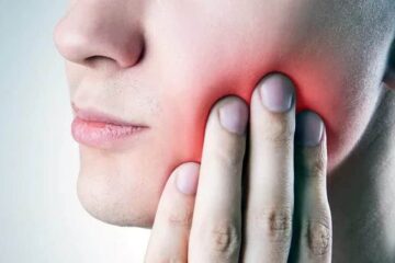 Férula Dental Brrnoo para Corregir Dientes Irregulares y Proteger