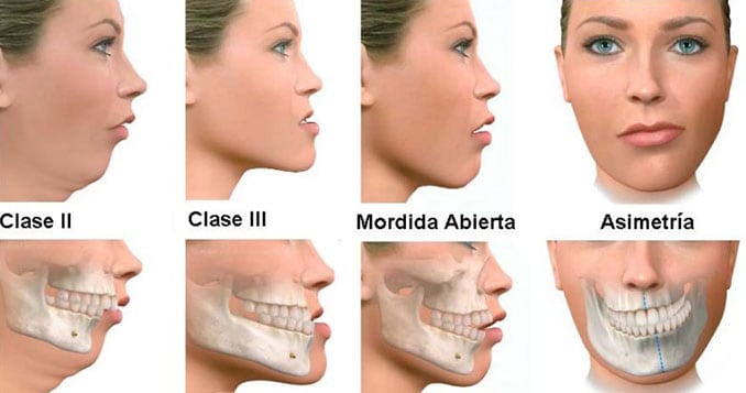 la cirugía Oral y Maxilofacial